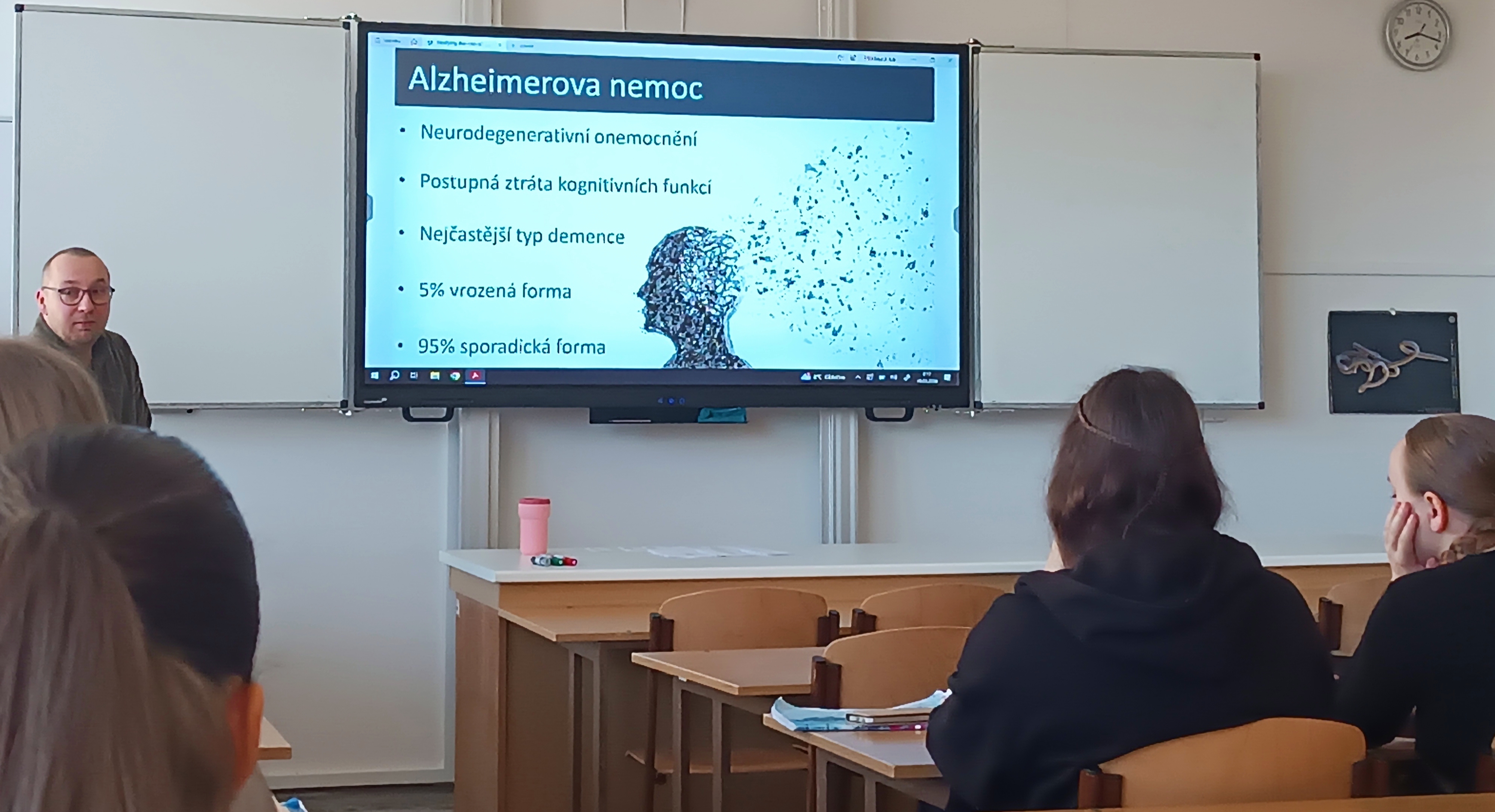 Alzheimer